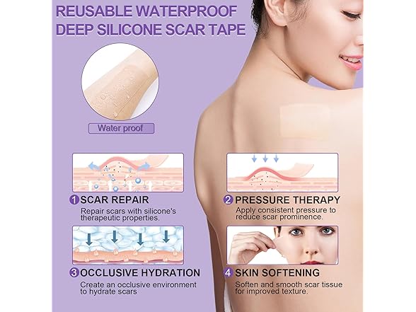 Mitgary Medical Grade Silicone Scar Tape