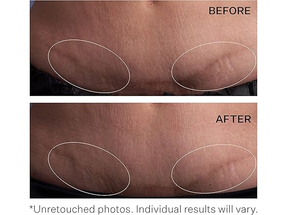 triVectin Anti-Wrinkle SD Moisturizing Concentrate: Your Choice