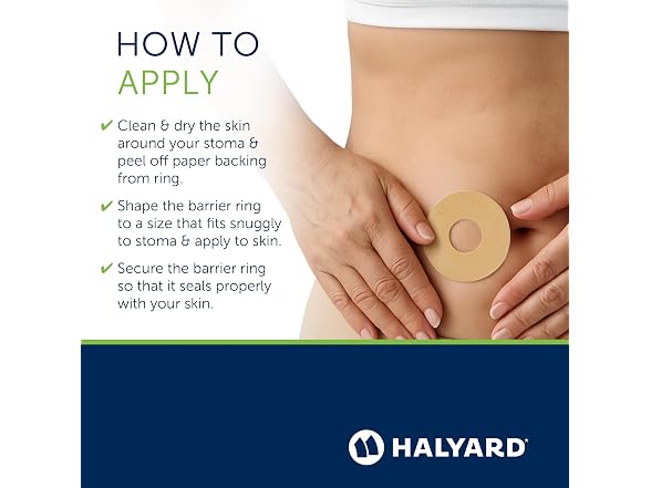 HALYARD Ostomy Conforming Skin Barrier Rings