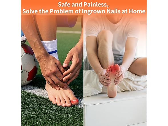 Ingrown Toenail Kit 10pc 5 Sizes