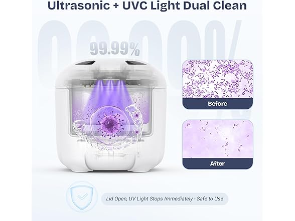 Newelkin Ultrasonic Retainer Cleaner
