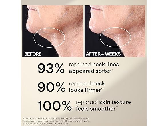 StriVectin Tightening Neck Serum Roller, 1.7 oz