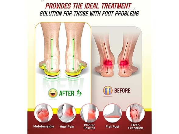 NEUPU Plantar Fasciitis Relief Insoles