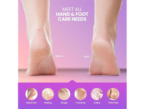 2-in-1 Electric Callus Remover for Feet
