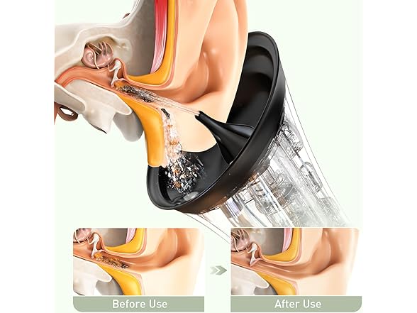 FlaoAito Ear Wax Removal Tool