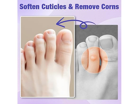 QIYANA Corn Remover Pads 30 Count