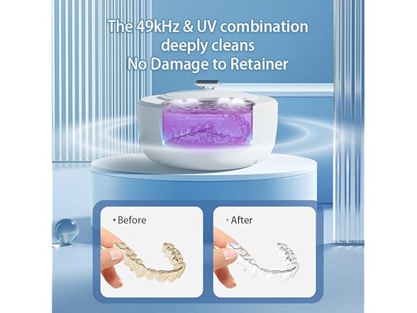 Ultrasonic Retainer Cleaner