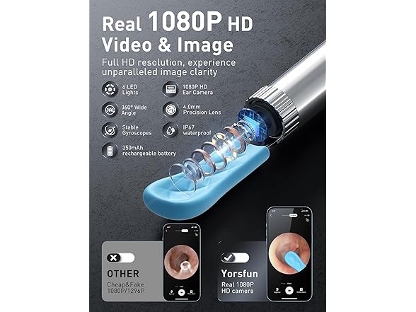 Yorsfun Ear Cleaner