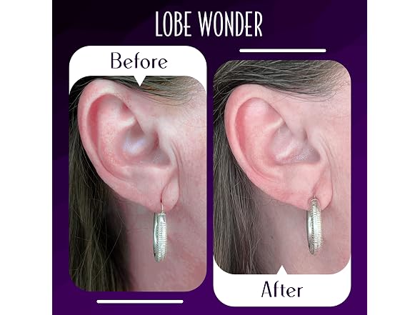 Lobe Wonder - The ORIGINAL Ear Lobe Piercings