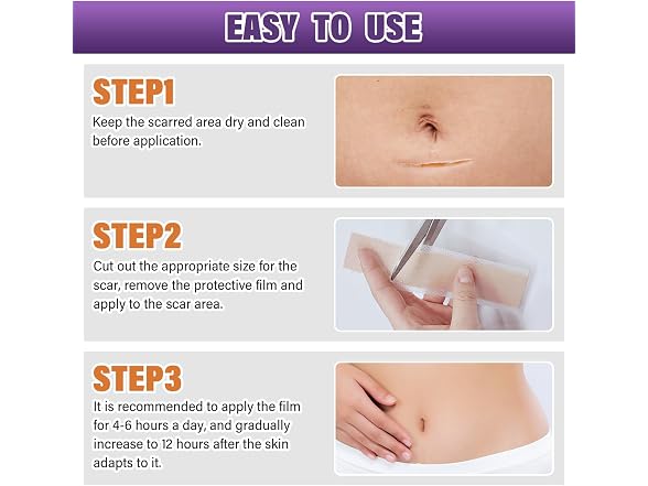 Silicone Scar Sheets