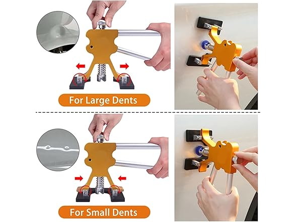 Dent Removal Kit