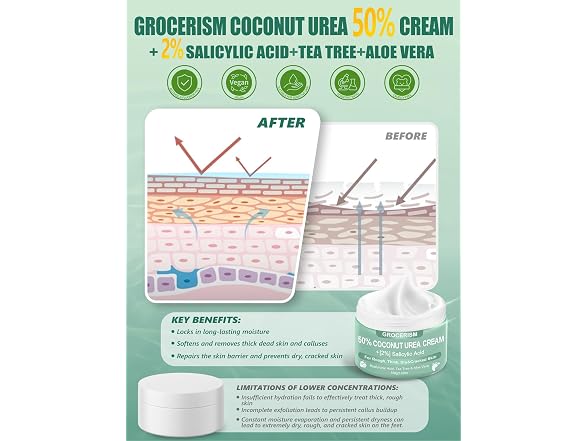 Grocerism 50% Coconut Urea Foot Cream Pack of 2