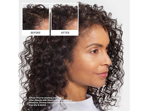 Nioxin Ultimate Power Hair Fall Defense Shamp 084A