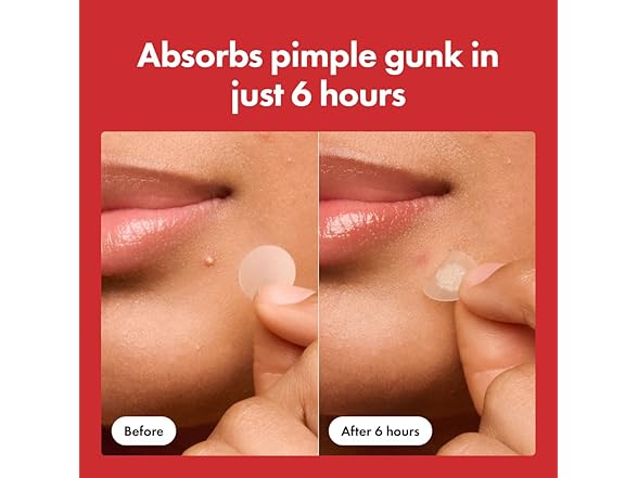 Mighty Patch Original Patch 75 Count