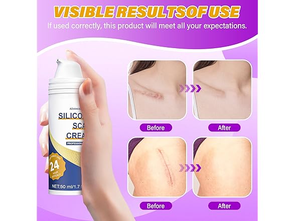 Psecici Silicone Scar Gel