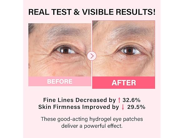 Collagen Boost Eye Patches