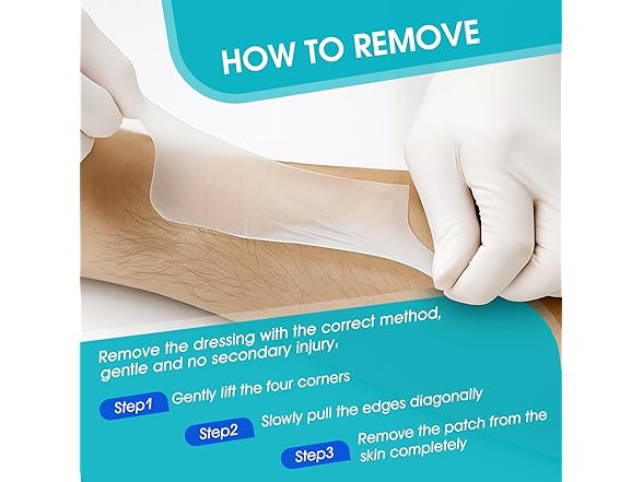 AKQFZHQ Hydrocolloid Roll for Wound Care