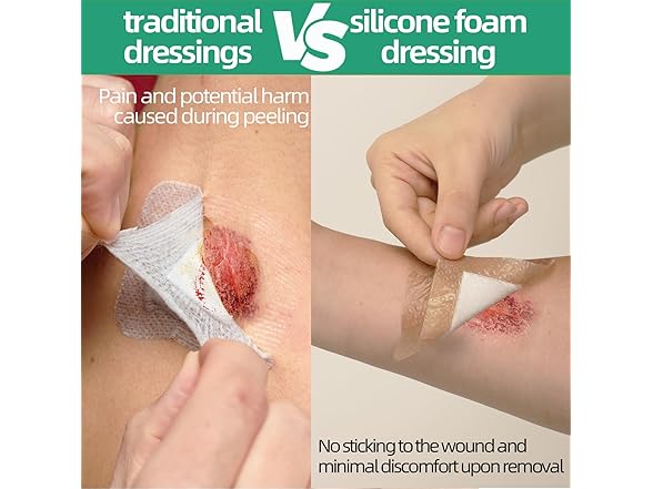 Jointown Foam Wound Care Dressing, Adhesive Silicone