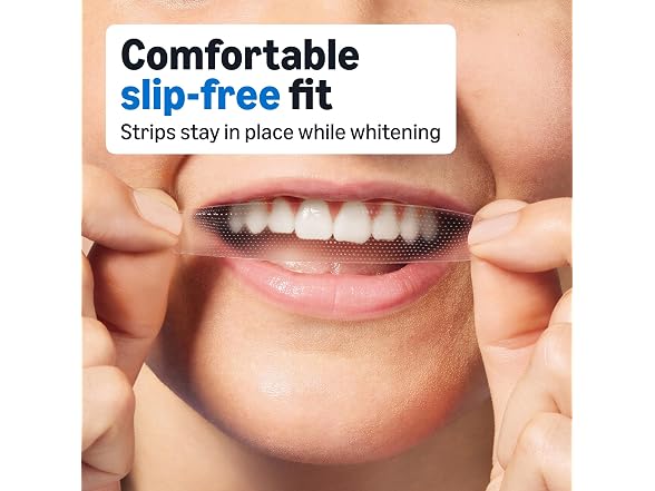 Amazon Basics Teeth Whitening Strips 10 Count