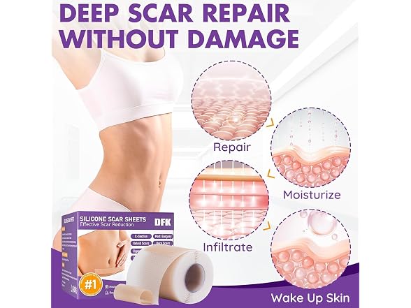DFK Silicone Scar Sheets