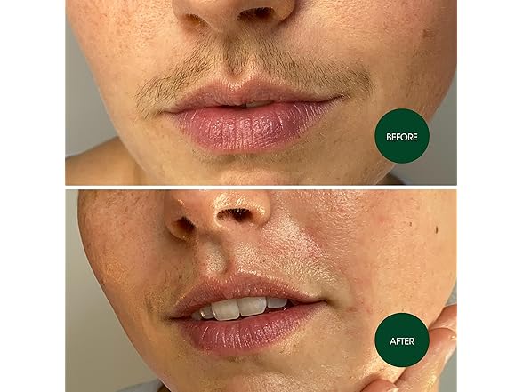 Nad's Facial Wax Strips