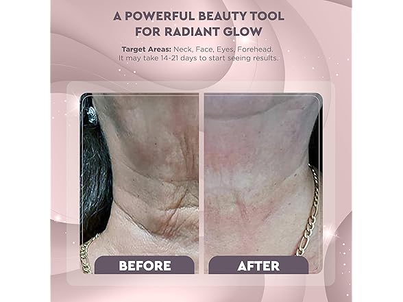 GLO24k BD2 Red Light for Face & Neck