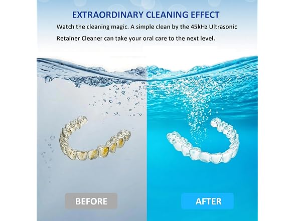 Ultrasonic Retainer Cleaner w/ Dryer