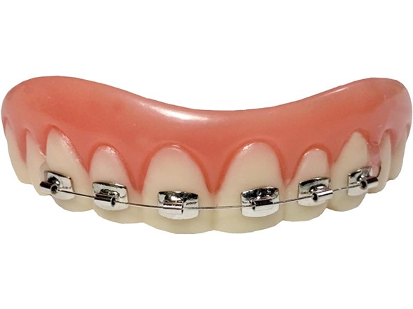 Braces over Choppers