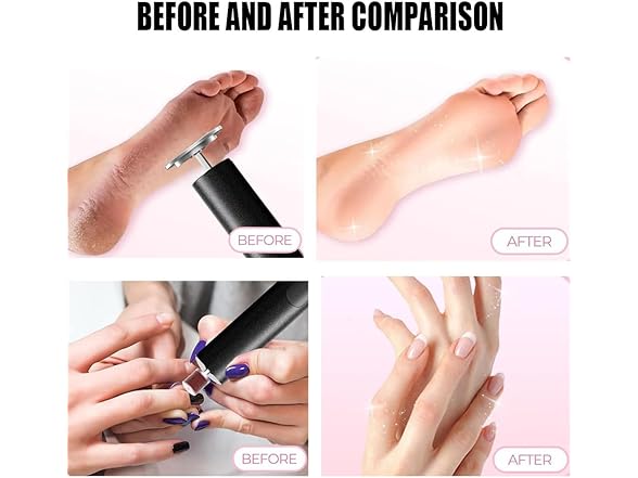Electric Callus Remover w/Nail File