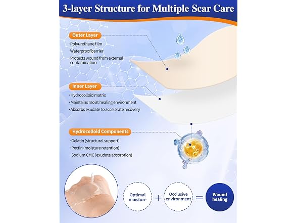 Nidkoud Hydrocolloid Roll for Wound Care