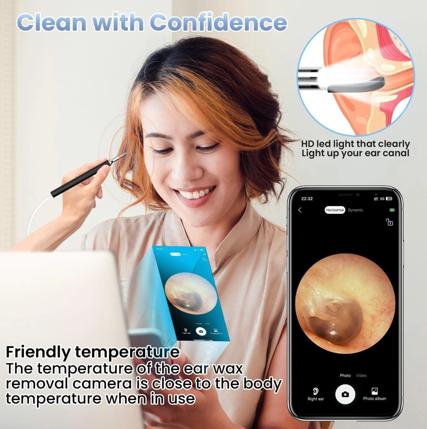 Ear Wax Removal 1080P Camera Tool - Gallery 12