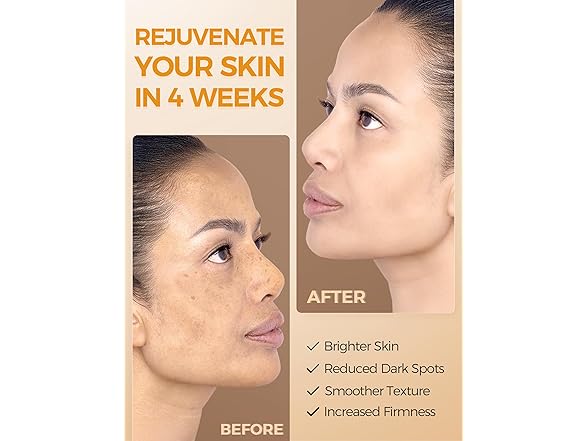 NING DERMOLOGIE Vitamin C Serum