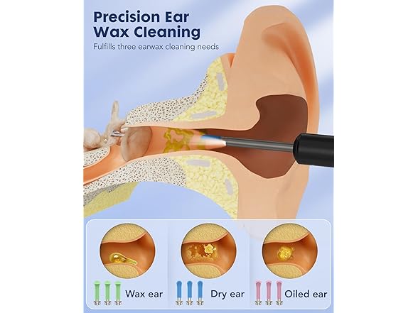 Littlelucky Ear Wax Removal Camera