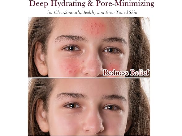 GEBEATY Skin Care Set for Pore Minimizing