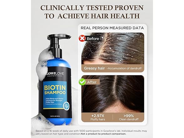 Biotin Shampoo for Hair Growth