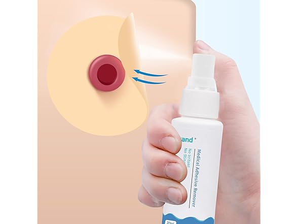 ovand  Medical Adhesive Remover