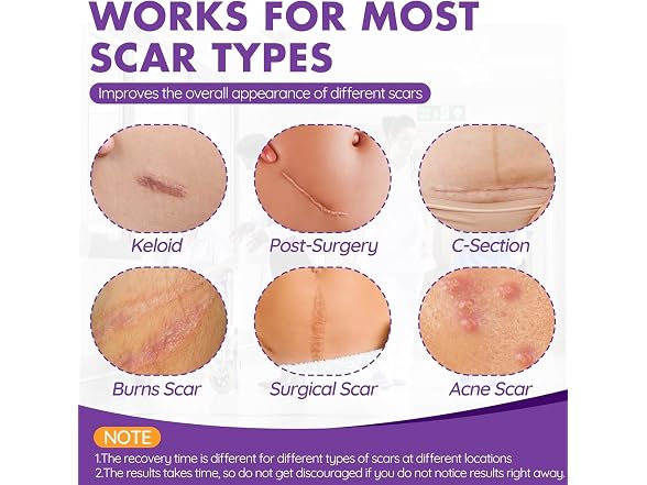 DFK Silicone Scar Sheets