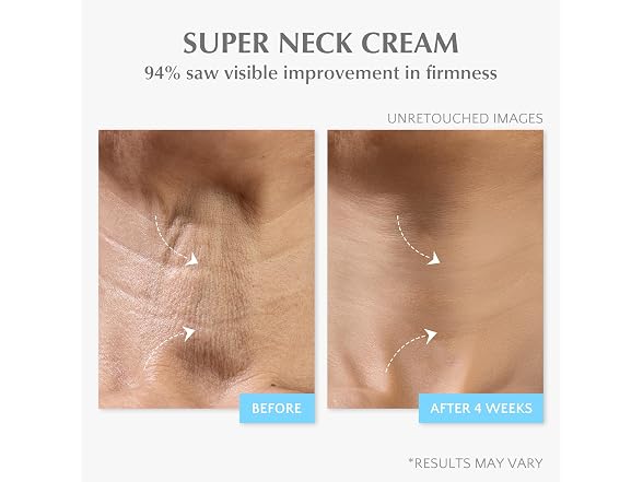 Retinol Collagen Face Cream: Wrinkle