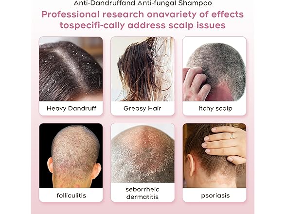 Itch Relief Anti-Fungal Shampoo