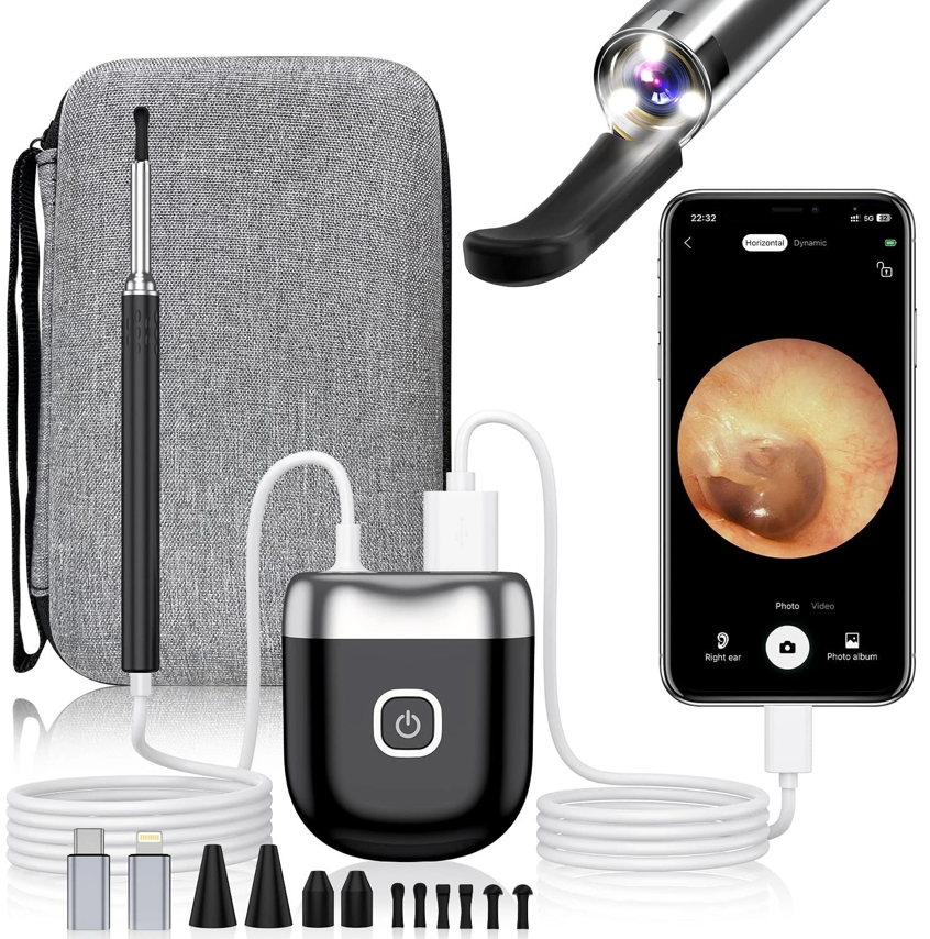 Ear Wax Removal 1080P Camera Tool - Gallery 8