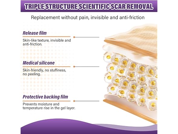 Silicone Scar Sheets