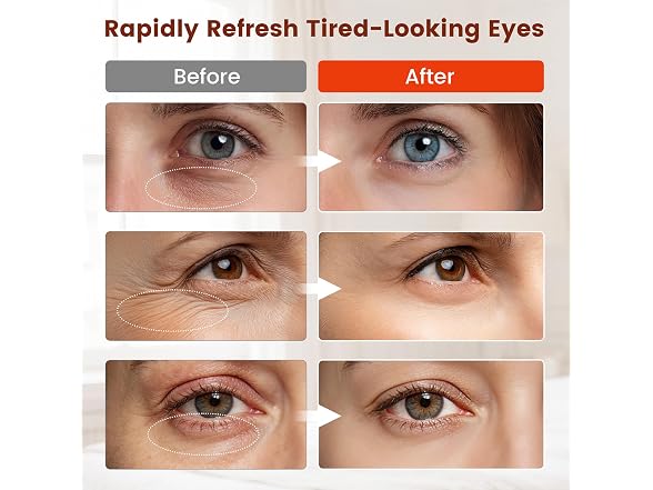 Viconor Red Light Therapy for Eyes Black