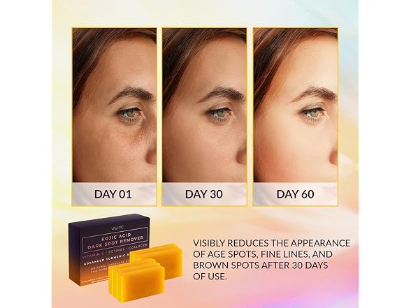Valitic Kojic Acid Dark Spot Remover Soap 5 Pack