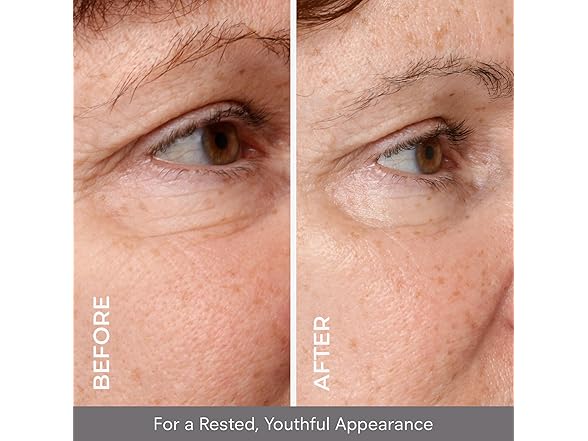 CosMedix Opti Crystal Eye Serum, 0.25 oz