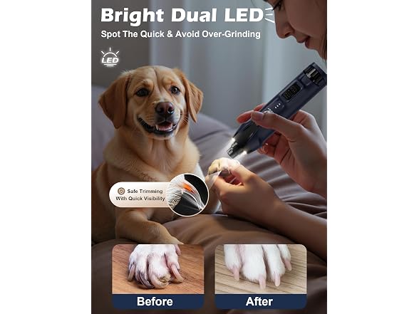 Casfuy 6-Speed Dog Nail Grinder