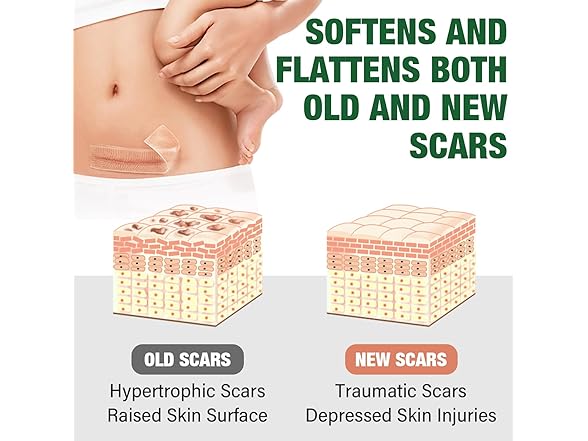 micakin Silicone Scar Tape