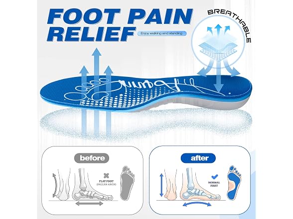 AnnyAm Arch Support Inserts for Plantar Fasciitis