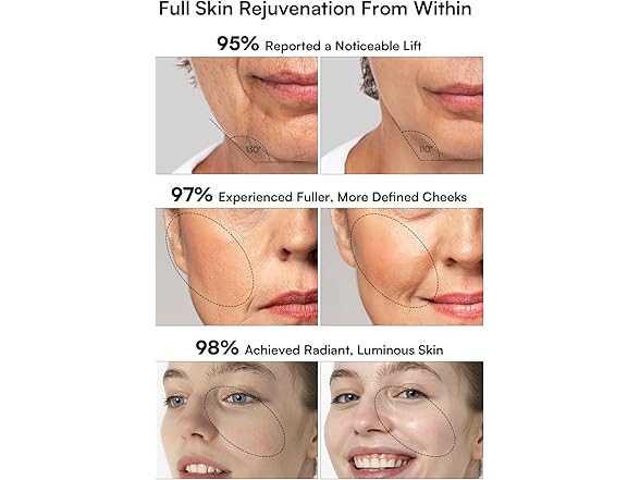 3-in-1 Red Light Skin Tightening Device