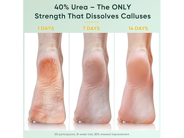 Berlaney Urea Cream 40 Percent For Feet