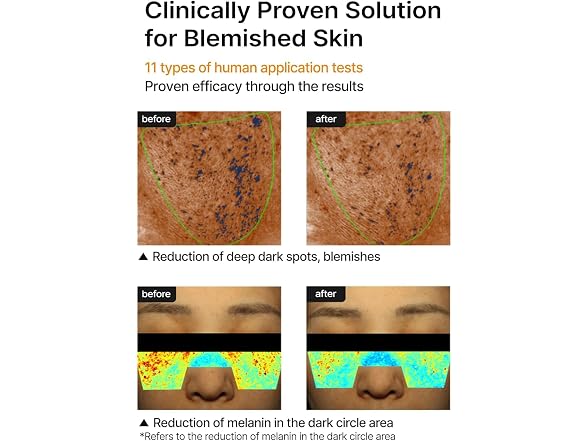 celimax Pore Dark Spot Brightening Cream